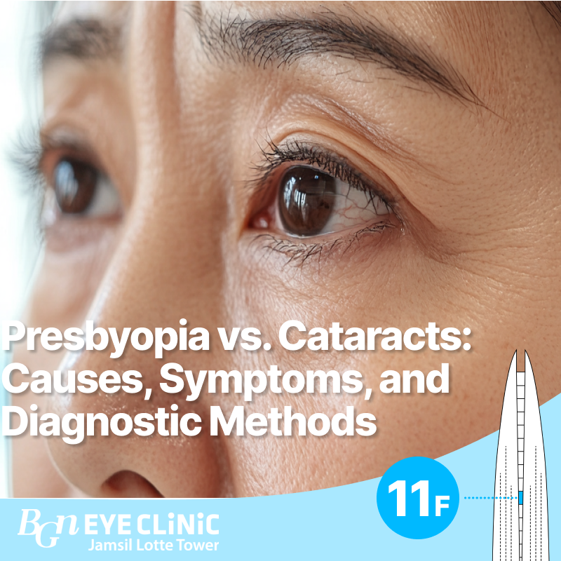 Presbyopia vs. Cataracts: Causes, Symptoms, and Diagnostic Methods